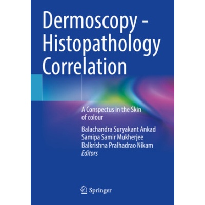 Dermoscopy - Histopathology Correlation | Balachandra Suryakant Ankad, Samipa Samir Mukherjee, Balkrishna Pralhadrao Nikam