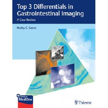 Image 1 of Top 3 Differentials in Gastrointestinal Imaging | Rocky Saenz