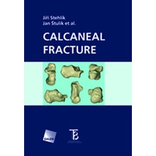 Calcaneal Fracture Jiří Stehlík, Jan Štulík