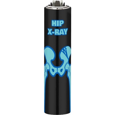 Clipper Metal Cover X-Ray 6