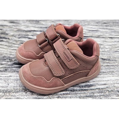 Protetika Ana dark pink – Zbozi.Blesk.cz