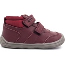 Protetika NELDA vínová