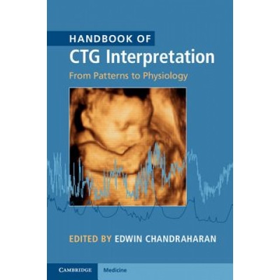 Handbook of CTG Interpretation
