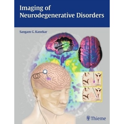 Imaging of Neurodegenerative Disorders - Kanekar, Sangam G.