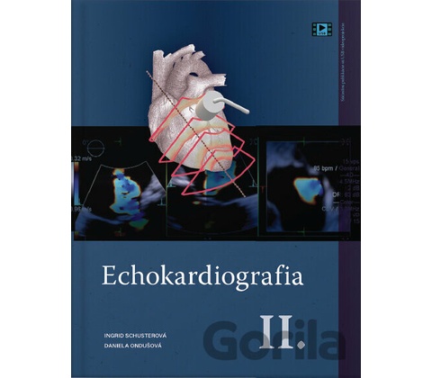 Echokardiografia II.