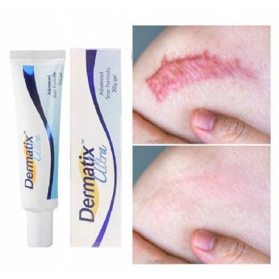 Dermatix Ultra silikonový Gel pro léčbu a prevenci jizev 15 g