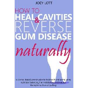 How to Heal Cavities and Reverse Gum Disease Naturally: a science-based, proven plan to heal teeth and gums using nutrition, balancing the metabolism, (ISBN: 9781542565684)
