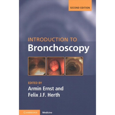 Introduction to Bronchoscopy | Armin Ernst, Felix J. F. Herth, Armin Ernst, Felix J. F. Herth