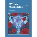 Myómy maternice - Mikuláš Redecha