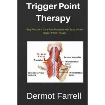 Trigger Point Therapy: Stop Muscle & Joint Pain Naturally with Easy to use Trigger Point Therapy