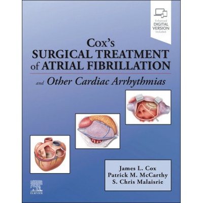 Cox’s Surgical Treatment of Atrial Fibrillation