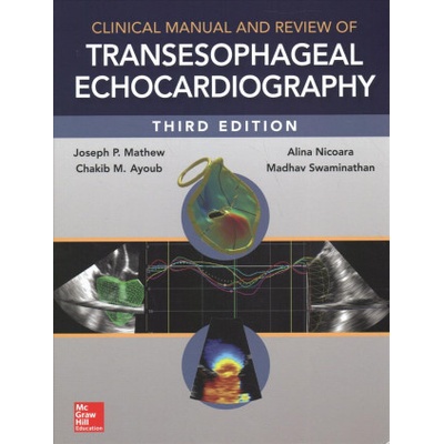 Clinical Manual and Review of Transesophageal Echocardiography, 3/e