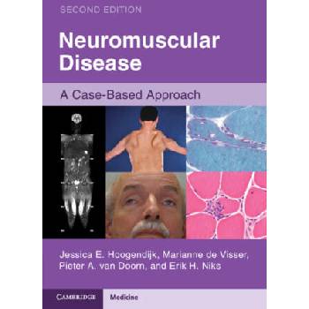 Image 1 of Neuromuscular Disease | Jessica E. (University Medical Center Utrecht) Hoogendijk, Marianne (Amsterdam University Medical Center) de Visser, van Doorn, Pieter A. (Erasmus MC, University Medical Center Rotterdam), Erik H. (Leide