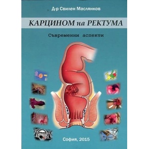 Карцином на ректума. Съвременни аспекти (ISBN: 9786191681310)