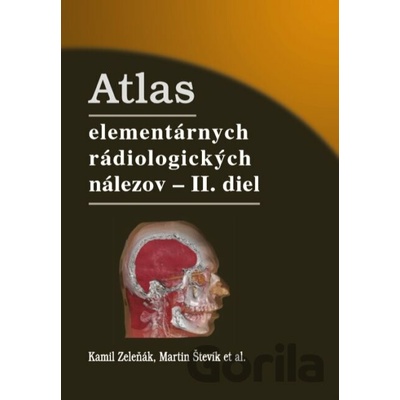 Atlas elementárnych rádiologických nálezov - II. diel
