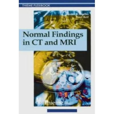Normal Findings in CT and MRI, A1, print | Emil Reif, Therald Moeller