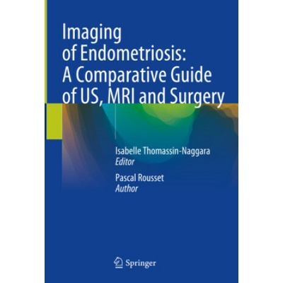 Imaging of Endometriosis: A Comparative Guide of US, MRI and Surgery