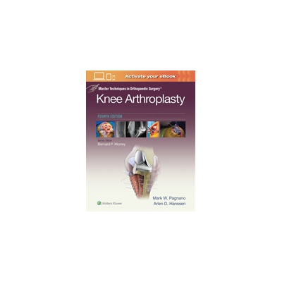 Master Techniques in Orthopedic Surgery: Knee Arthroplasty Pagnano Mark W.Pevná vazba
