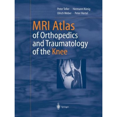 MRI Atlas of Orthopedics and Traumatology of the Knee (Peter Teller,Hermann König,Ulrich Weber,Peter Hertel)(Brožovaná)