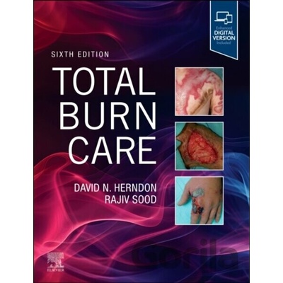 Total Burn Care - David Herndon, Rajiv Sood