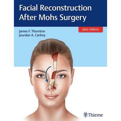 Facial Reconstruction After Mohs SurgeryPevná vazba