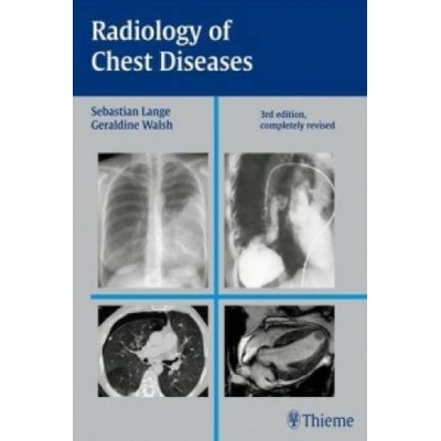 Radiology of Chest Diseases - Sebastian Lange