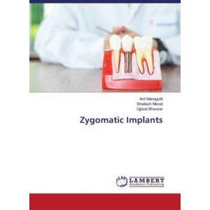 Zygomatic Implants | Shailesh Menat, Ujjaval Bhavsar (ISBN: 9786204984766)