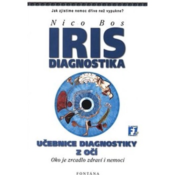 Iris diagnostika