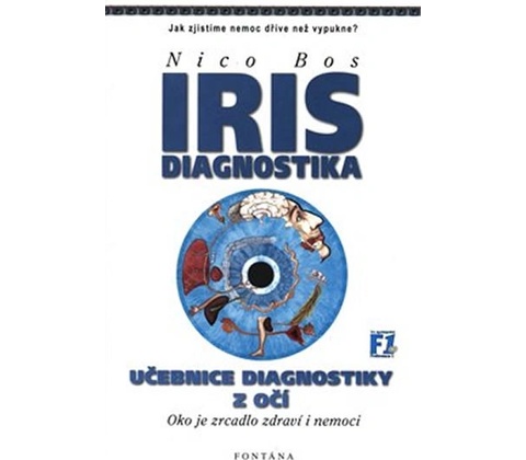 Iris diagnostika