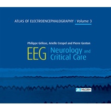 Atlas of Electroencephalography Volume 3 Gelisse Dr Philippe