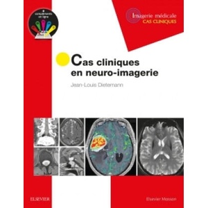 Cas cliniques en neuro-imagerie | Jean-Louis Dietemann (ISBN: 9782294751998)