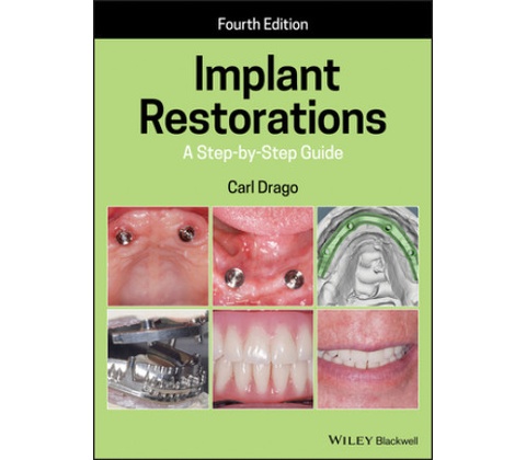 Implant Restorations