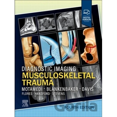 Diagnostic Imaging: Musculoskeletal Trauma