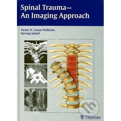 Spinal Trauma