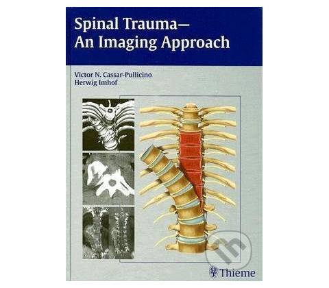 Spinal Trauma