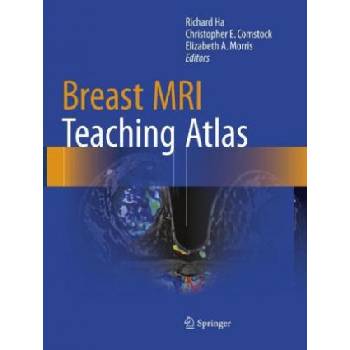 Breast MRI Teaching Atlas | Richard Ha, Christopher E. Comstock, Elizabeth A. Morris