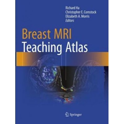 Breast MRI Teaching Atlas | Richard Ha, Christopher E. Comstock, Elizabeth A. Morris