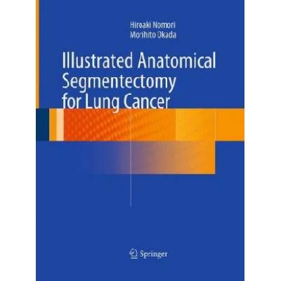 Illustrated Anatomical Segmentectomy for Lung Cancer | Hiroaki Nomori, Morihito Okada