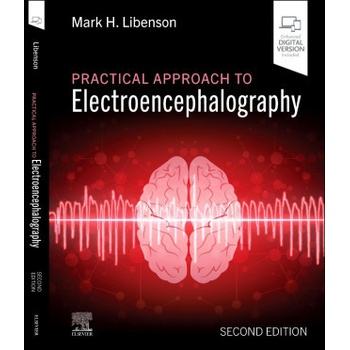 Practical Approach to Electroencephalography