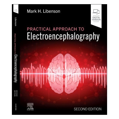 Practical Approach to Electroencephalography