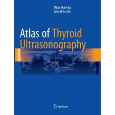 Atlas of Thyroid Ultrasonography | Milan Halenka, Zdenek Frysak