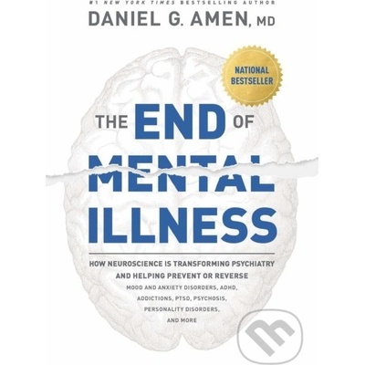 The End of Mental Illness: How Neuroscience Is Transforming Psychiatry and Helping Prevent or Reverse Mood and Anxiety Disorders, Adhd, Addiction Amen Daniel G.Paperback