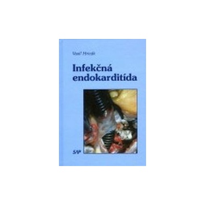 Infekčná endokarditída - Vasiľ Hricák