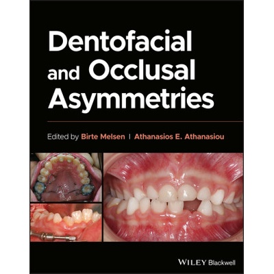 Dentofacial and Occlusal Asymmetries | Athanasios E. Athanasiou
