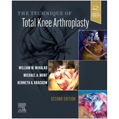 Technique of Total Knee Arthroplasty | William M. Mihalko, Michael A. Mont, Kenneth Krackow