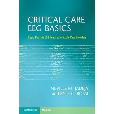 Critical Care Eeg Basics: Rapid Bedside Eeg Reading for Acute Care Providers (Jadeja Neville M.)