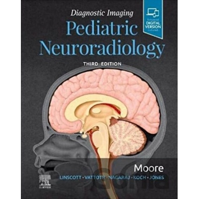 Diagnostic Imaging: Pediatric Neuroradiology - Kevin R. Moore