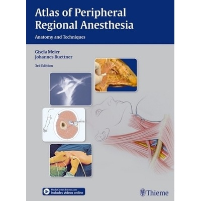 Atlas of Peripheral Regional Anesthesia - Meier Gisela