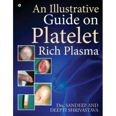 Illustrative Guide on Platelet Rich Plasma | Dr Deepti Shrivastava