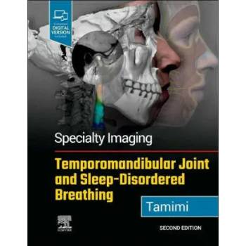 Image 1 of Specialty Imaging: Temporomandibular Joint and Sleep-Disordered Breathing | Dania F. Tamimi
